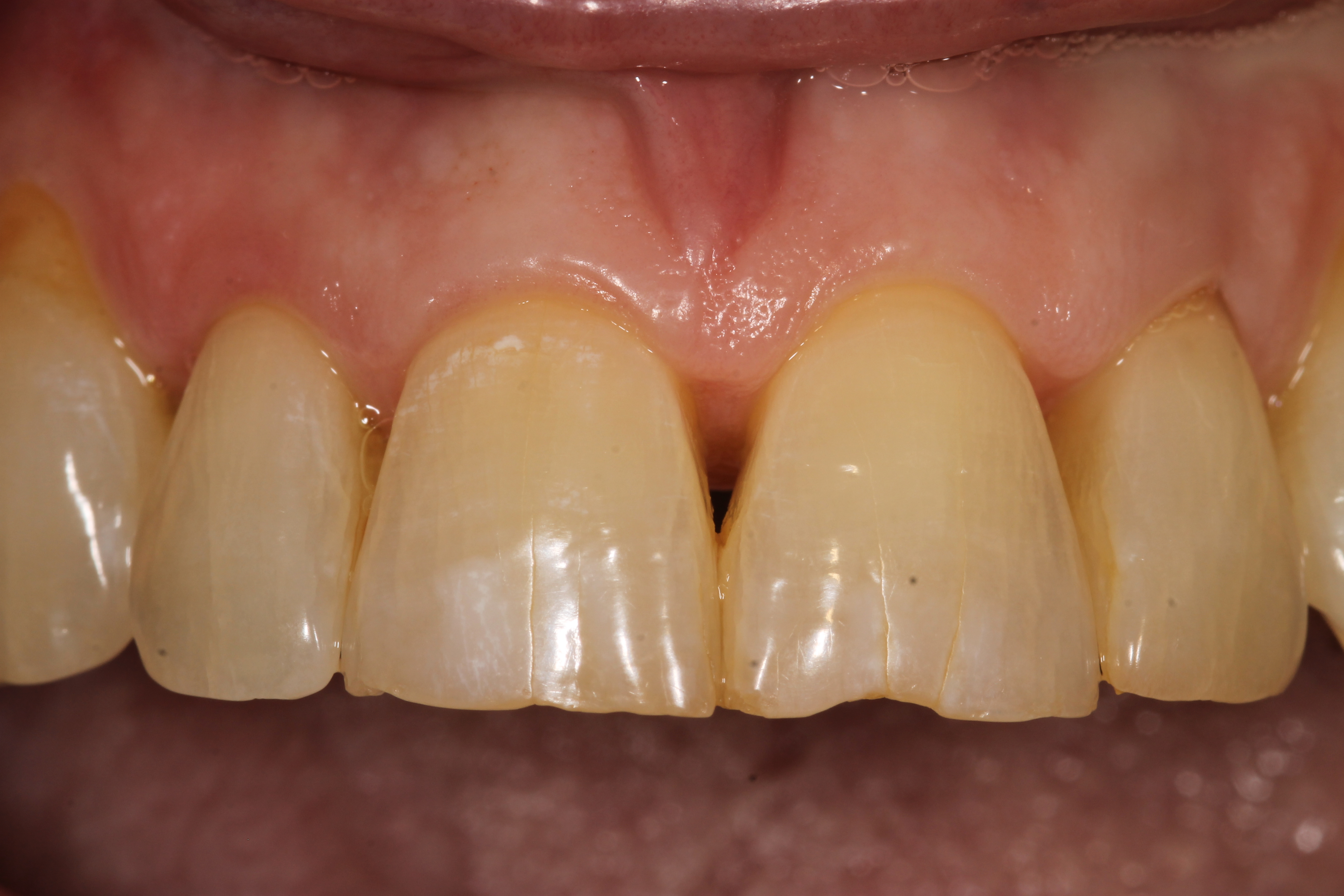 Before